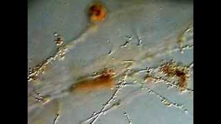 Bacteria Fungi Protozoa and Nematodes from soil [upl. by Akino]