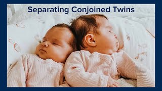 Separating Conjoined Twins at UC Davis Childrens Hospital [upl. by Antebi]