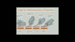 💉How to select angles of administration of injection aiims injection meditutor [upl. by Cesya]