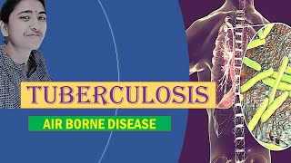 TUBERCULOSIS II MEDICAL MICROBIOLOGY II AIRBORNE DISEASE [upl. by Cyrus463]