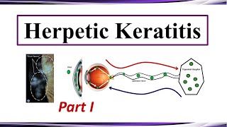 Herpetic Keratitis  Pathogenesis and Clinical Presentation Part I [upl. by Eibbob666]