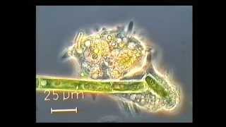 Amoeba eating a green algae [upl. by Claudine35]