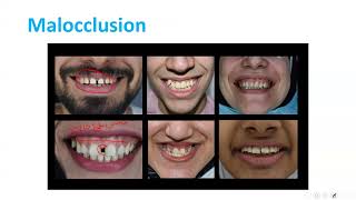 lecture 3 Normal occlusion [upl. by Eilerua]