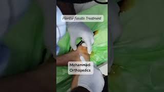 Plantar fasciitis treatment at Mohammadi Orthopaedics [upl. by Ateuqal23]