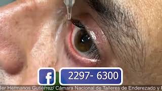 ENDORET PARA EL OJO SECO PTERIGIÓN Y CORNEA SALUD Y ALGO MÁS CANAL 11 Y 4 16 MARZO 2024 [upl. by Rodgers]