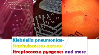 KlebsiellaStaphylococcus Betahaemolytic Streptococci Enterococcus Serratia Micrococcus [upl. by Dnomyad404]