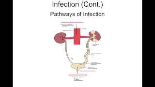 Chapter 27 Intrarenal Disorders BIOL300 [upl. by Earej]