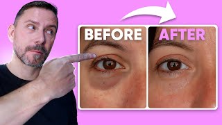 HOW TO MAKE EYE BAGS VANISH IN SECONDS FULL DEMO [upl. by Pen]