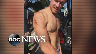 Surfer punches shark in face to escape attack [upl. by Lienaj]