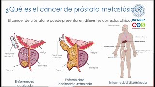 Enfermedad Metastásica por Cáncer de Próstata  INCMNSZ  Educación para la Salud [upl. by Hannah]