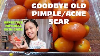 KAMATIS TOMATO EPEKTIBONG PANTAGGAL NG PEKAS AT OLD ACNE SCARS SA MUKHAkamatisantiblemishes [upl. by Edmonda]