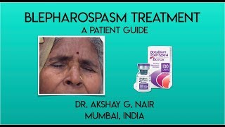 Blepharospasm Hemifacial Spasm  Facial Spasms  Eyelid Spasm Treatment with Botox Botulinum Toxin [upl. by Yelsiap]