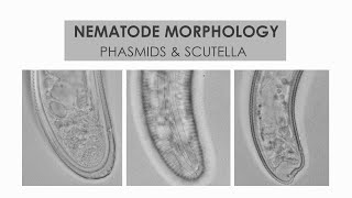 NEMATODE MORPHOLOGY PHASMIDS AND SCUTELLA [upl. by Hartzell]