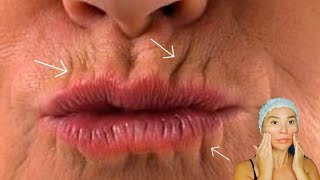 5 ways to GET RID of LIP WRINKLES  Lift up lip corners  Smokers lines [upl. by Essenaj]