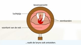 Keelontsteking  de oorzaak en behandeling [upl. by Kiraa]