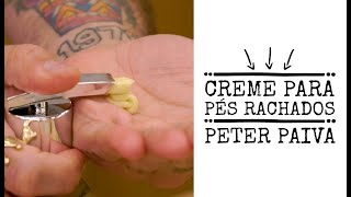 Creme para pés rachados  Peter Paiva [upl. by Zerimar483]