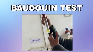 Baudouin test for Ghee [upl. by Giselbert79]