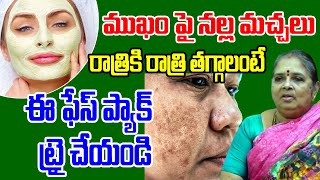 Dark Spots on Face  ముఖం పై నల్ల మచ్చలు రాత్రికి రాత్రి తగ్గాలంటే ఈ ఫేస్ ప్యాక్ ట్రై చేయండి [upl. by Cioban]