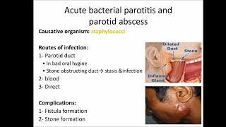 salivary gland infections [upl. by Alyk739]