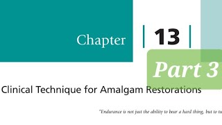 Clinical Technique for Amalgam Restorations part 3 Class 2 Amalgam Restorations Matrix and Wedges [upl. by Maura]