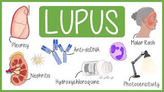 Systemic Lupus Erythematosus in 3 Minutes [upl. by Ries297]