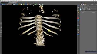 Manual 3D rib cage bones segmentation [upl. by Alletsirhc581]