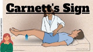 Carnetts Sign in Abdominal Examination  Clinical Insight for MBBS Students  Novice Medic [upl. by Haral]