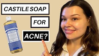 Castile soap for the face why its a really bad idea [upl. by Redyr]