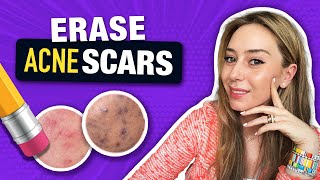 How to Treat amp Fade Acne Scars like a Dermatologist  Dr Shereene Idriss [upl. by Maguire]