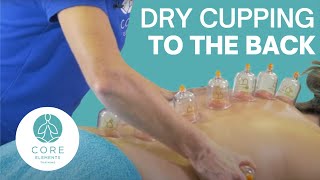 Clinical Dry Cupping to the Back including the spinous processes [upl. by Toland504]