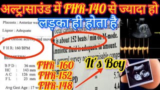 Ultrasound में लड़के की क्या पहचान हैFHR140 से ज्यादा लड़का होता हैं या लड़कीBaby Boy ultrasound🤱🏻 [upl. by Marba]