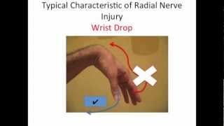 Radial Nerve Test [upl. by Morrison327]