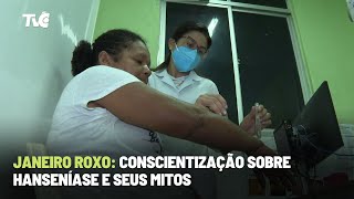 Janeiro Roxo Conscientização sobre Hanseníase e seus mitos [upl. by Brittni]