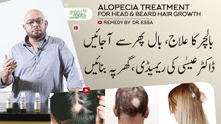 Alopecia treatment for head amp beard hair  alopecia hair growth oil Easy to make remedy by Dr Essa [upl. by Asylla756]