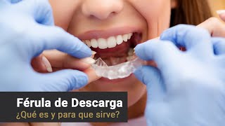 Provenza Clínica Dental  Férula de descarga [upl. by Esilahc]