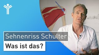 Sehnenriss an der Schulter Warum Sie Ihre Schulterschmerzen rechtzeitig behandeln lassen sollten [upl. by Derfnam638]