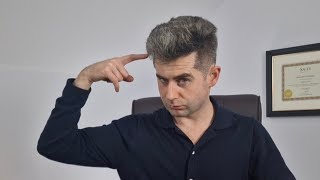 4 ways to tell Finasteride is working for hair loss [upl. by Horne]