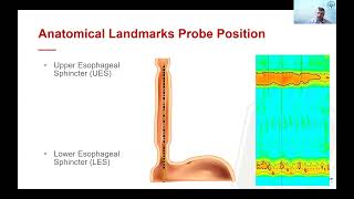 Manometry 101 What is Manometry Evolution How it Works and How its Performed [upl. by Ultima]