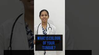 What is the colour of your tongue youtube shorts health tongue healthy cure disease free yt [upl. by Renato]