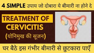 सर्विसाइटिस Cervicitis के घरेलू इलाज । CERVICITIS CURE । Treatment of Cervicitis [upl. by Ree855]