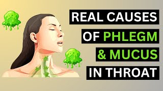 The Real Causes of Constant PHLEGM amp MUCUS In Your Throat [upl. by Munafo]