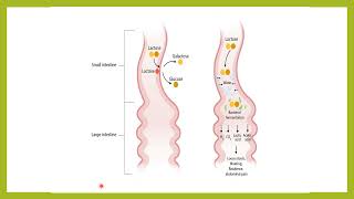 Acute gastroenteritis Dr Alaa AlDalaien Lecture Mutah University [upl. by Maggi]