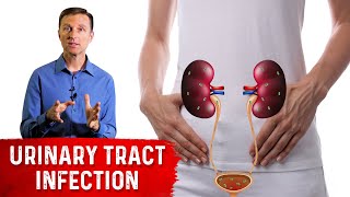 Top Remedies for a UTI Urinary Tract Infection Updated [upl. by Onahpets]