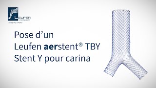 Pose dun Leufen aerstent® TBY [upl. by Arten]