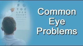 Common Eye Problems [upl. by Yrral]