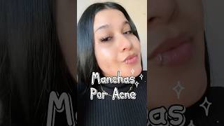 Que es Thiamidol de Eucerin Y para que sirve⁉️ Annie Liz skincare contornodeojos acne skin [upl. by Sarad]