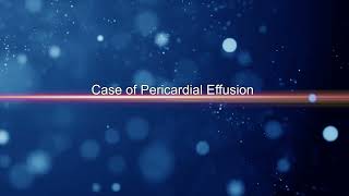 Pericardial Effusion [upl. by Leandro]