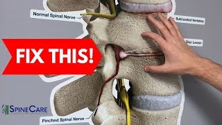 How to Fix a Bulging Disc in Your Lower Back  RELIEF IN SECONDS [upl. by Anera892]