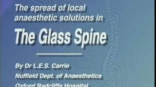 Isobaric vs hyperbaric in glass spine [upl. by Kiehl800]