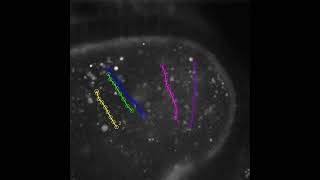 Cytoplasmic Streaming of Female Drosophila at Stage 11 Oogenesis Manual Particle Tracking SC [upl. by Alimat157]